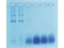 TRENNUNG VON DNA-RNA DURCH SAULENCHROMATOGRAPHIE