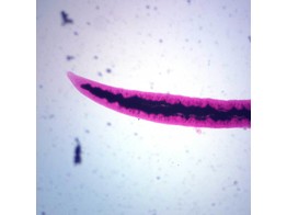 PREPARAAT - SCHISTOSOMA JAPONICUM IN COPULA  W.M