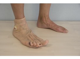 PIED DIABETIQUE PORTABLE