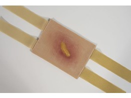 BLESSURE DE FEU PORTABLE