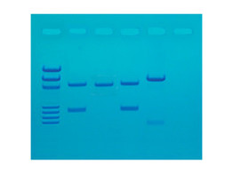 DNA-FINGERPRINTING DURCH PCR-AMPLIFIKATION