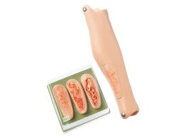 RIGHT LEG WITH 4 CRURAL ULCER INSERTS