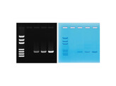 PCR-AMPLIFIKATION VON DNA