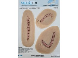 SHEET POST SURGICAL WOUNDS SUTURES
