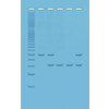 MENSELIJKE DNA ANALYSE VIA PCR - EDVOTEK - 333