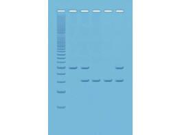 ALU-HUMAN-DNA-TYPISIERUNG MITTELS PCR - EDVOTEK - 333