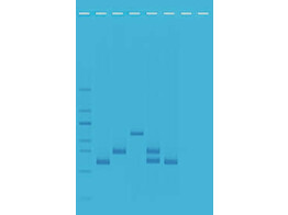 MULTIPLEXE PCR-BASIERTE TESTS VON WASSERVERUNREINIGUNGEN- EDVOTEK - 953