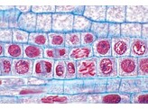 PREPARATION MICROSCOPIQUE  D ADN DANS DES NOYAUX CELLULAIRES