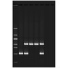 MENSELIJKE DNA ANALYSE VIA PCR - EDVOTEK - 333