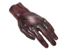 SIMULAIDS  SIMULATED 1ST  2ND AND 3RD DEGREE BURN TO THE LEFT HAND