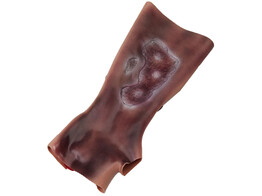 SIMULAIDS  SIMULATED 2ND   3RD DEGREE BURN OF FOREARM