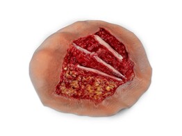 SIMULAIDS  SIMULATED 4TH DEGREE CHEMICAL BURN   DORSAL HAND
