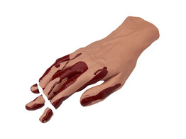 SIMULAIDS  SIMULATED HAND WITH SEVERED FINGERS