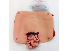 SIMULAIDS  SIMULATION  ABDOMINAL WOUND W/PROTRUDING INTESTINES