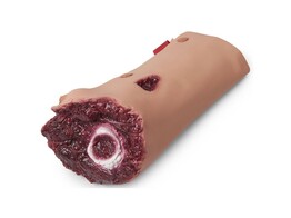 SIMULAIDS  SIMULATION LEG AMPUTATION