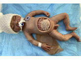 NEW BORN SURGICAL SIMULATION BABY - OLIVER
