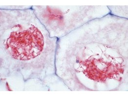 Lilium  Antheren quer. Pollenmutterzellen  Prophase. Leptotan  Spiremstadium der Chromosomen