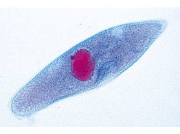 Paramaecium  macro- and micronuclei stained. The typical slide for general study of this common ciliate