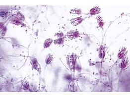 Penicillium  moisissure  mycelium et conidiophores p.e.