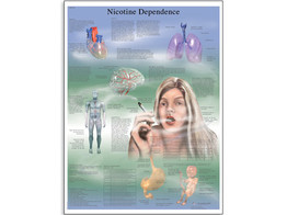 NICOTINE DEPENDENCE CHART - VR1793L  1001622 
