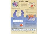 HIV AND AIDS CHART - VR1725L  1001610 