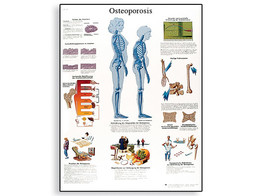 OSTEOPOROSIS CHART - ENGLISH - VR1121L  1001472 