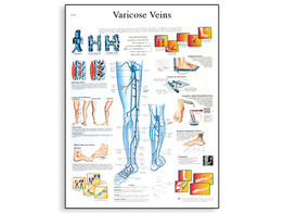 VARICOSE VEINS CHART - VR1367L  1001534 