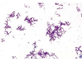 Proteus vulgaris  Faulnisbakterien  Ausstrich