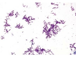 PROTEUS VULGARIS  UITSTRIJK