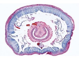 REGENWORM DWARSE DOORSNEDE