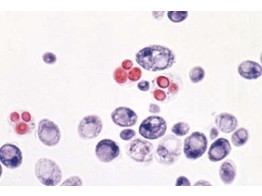 SACCHAROMYCES SP. GIST   COMPL