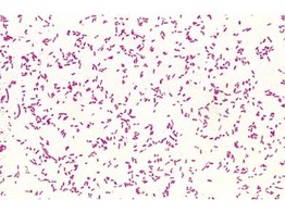 SALMONELLA THYPHOSA  UITSTRIJK