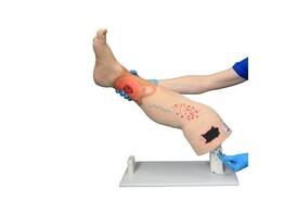 VINNIE VENOUS INSUFFICIENCY LEG
