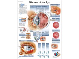 DISEASES OF THE EYE CHART -  PAPER -VR1231UU