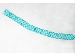 SPIROGYRA SP  - VEGETATIVE MASS  W.M. - SB.2381A