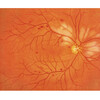 SIMULATEUR D EXAMEN OCULAIRE PEAU CLAIRE - M82
