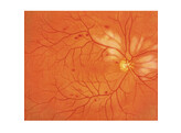 SIMULATEUR D EXAMEN OCULAIRE PEAU CLAIRE - M82