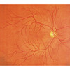 SIMULATEUR D EXAMEN OCULAIRE PEAU CLAIRE - M82