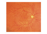 SIMULATEUR D EXAMEN OCULAIRE PEAU CLAIRE - M82