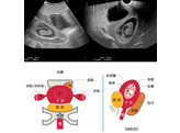 ENSEMBLE COMPLET DE MANNEQUINS POUR ECHOGRAPHIE PELVIQUE FEMININE  10 SEMAINES  - US-10C