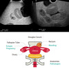 ENSEMBLE COMPLET DE MANNEQUINS POUR ECHOGRAPHIE PELVIQUE FEMININE  10 SEMAINES  - US-10C