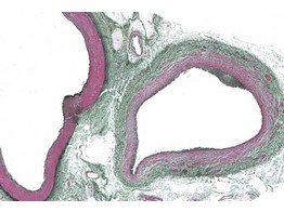 Artere et veine de l homme c.t. coloration des fibres elastiques