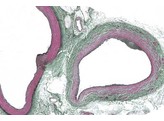 Artere et veine de l homme c.t. coloration des fibres elastiques