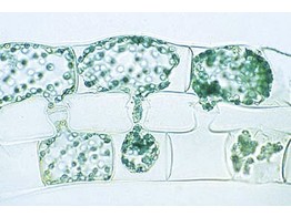 Spirogyra  in scalariform conjugation and after the stage of conjugation  w.m.