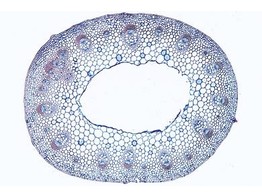 Ranunculus  Hahnenfu   Stamm mit offenen kollateralen Leitbundeln  quer