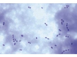 Streptococcus lactis  Milchsaurebildner. Milchausstrich mit kurzen Ketten