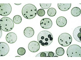 Volvox  spherical colonies with daughter colonies and sexual stages w.m.