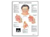 RHINITIS AND SINUSITIS  CHART