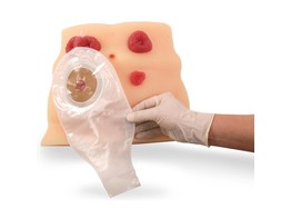 STOMA VERZORGINGSMODEL-W43027  1005570 