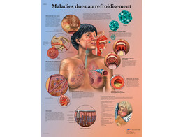 POSTER MALADIES DUES AU REFROIDISEMENT - VR2253L